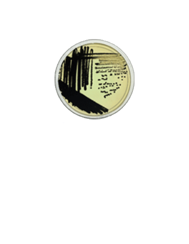 Rainbow Agar Salmonella