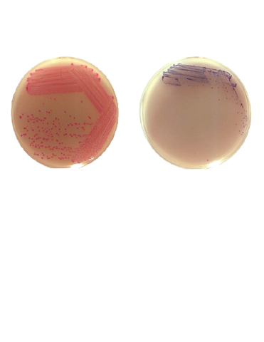 Rainbow Agar Shigella/Aeromonas